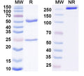 SDS-PAGE for Anti-Human CD121a/IL1R1 Antibody (15C4)