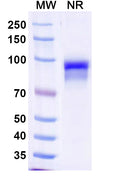 SDS-PAGE for Anti-Human CFP/Properdin Antibody (SAA1485).