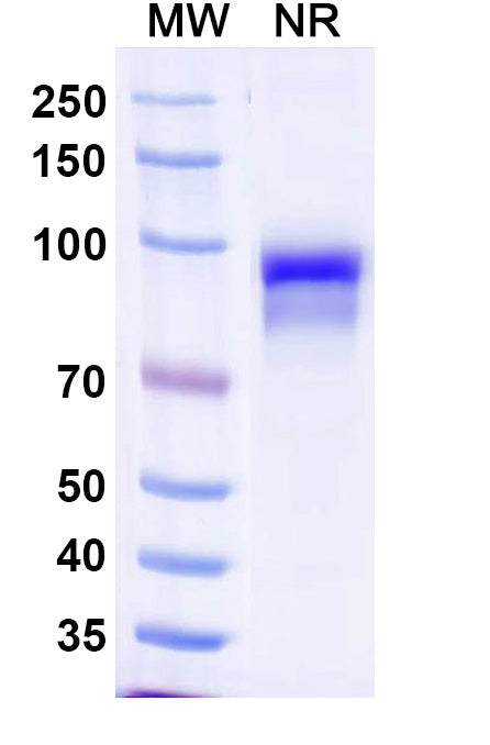 SDS-PAGE for Anti-Human CFP/Properdin Antibody (SAA1485).