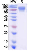 Recombinant Human CD6 Protein, C-His