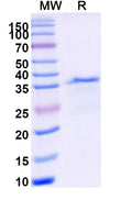 Recombinant Human CD11a/ITGAL Protein, N-His