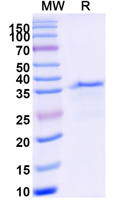 Recombinant Human CD11a/ITGAL Protein, N-His