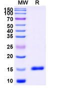 SDS-PAGE for Anti-Human CD11a/ITGAL Nanobody (SAA1305)