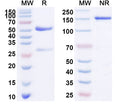 SDS-PAGE for Rabbit Anti-Human CD11a/ITGAL Antibody (SAA0004)