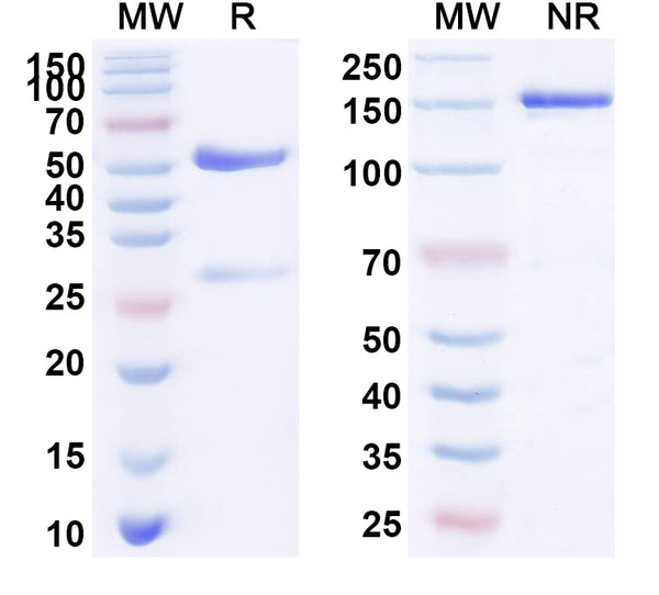 SDS-PAGE for Rabbit Anti-Human CD11a/ITGAL Antibody (SAA0004)