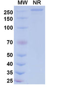 Anti-Human EDNRA/Endothelin R Type A Reference Antibody (Patecibart) – Figure 1 of 1