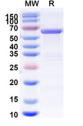 Recombinant Human PKM Protein, N-His