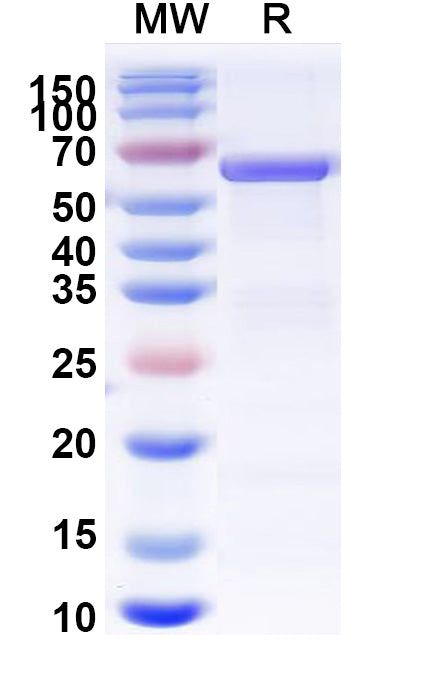 Recombinant Human PKM Protein, N-His