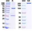 Anti-Human IFN-alpha/beta R1 Reference Antibody (Anifrolumab) – Figure 1 of 2