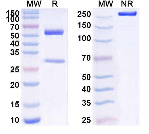 SDS-PAGE for Anti-Human IL1RN/IL-1ra/IL1F3 Antibody (SAA1542)