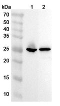 Western blot analysis was performed using anti-TNNI3 polyclonal antibody at 1ug/mL on various samples.
Lane 1: Mouse heart lysate
Lane 2: Rat heart lysate