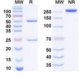 SDS-PAGE for Anti-Human TNNI3/cTNI Monoclonal Antibody (1A349)