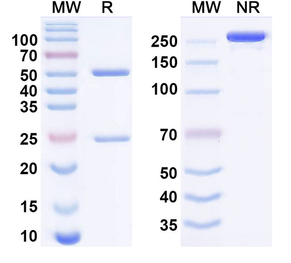 SDS-PAGE for Anti-Human TNNI3/cTNI Monoclonal Antibody (1A349)