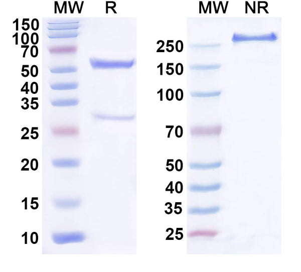 SDS-PAGE for Anti-Human NT-ProBNP Monoclonal Antibody (1A344)
