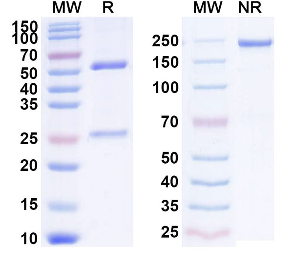 SDS-PAGE for Anti-Human NT-ProBNP Monoclonal Antibody (1A345)