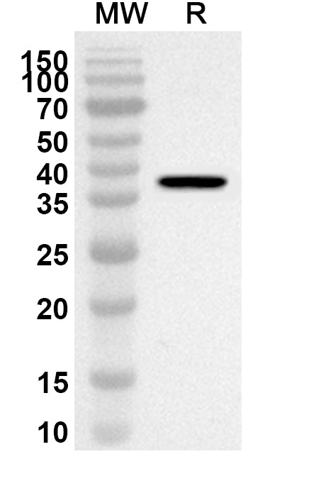 Western blot analysis was performed using anti-Human MAPK4 polyclonal antibody at 1ug/mL on recombinant Human MAPK4 (Catalog No. HB842012).
