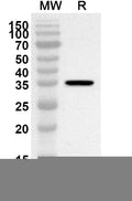 Western blot analysis was performed using anti-CDK2 polyclonal antibody at 1ug/mL on recombinant CDK2 (Catalog No. HB845022).