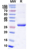 Recombinant Human TSHR Protein, N-His