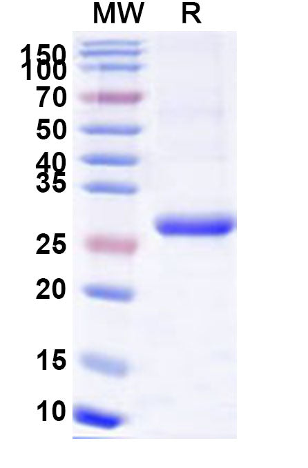 Recombinant Human TSHR Protein, N-His