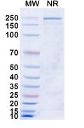 SDS-PAGE for Anti-Human TSHR/LGR3 Antibody (M22)
