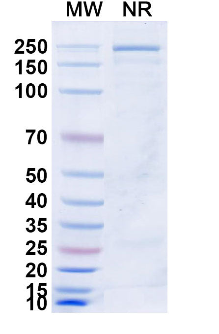 SDS-PAGE for Anti-Human TSHR/LGR3 Antibody (M22)
