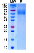 Recombinant Human CD334/FGFR4 Protein, C-His