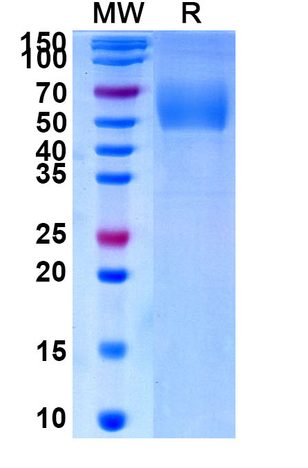 Recombinant Human CD334/FGFR4 Protein, C-His