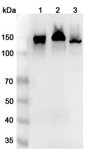 Western blot analysis was performed using anti-CDH2 polyclonal antibody at 1μg/ml on various samples.
Lane 1: Mouse heart lysate
Lane 2: Rat heart lysate
Lane 3: Rat brain lysate