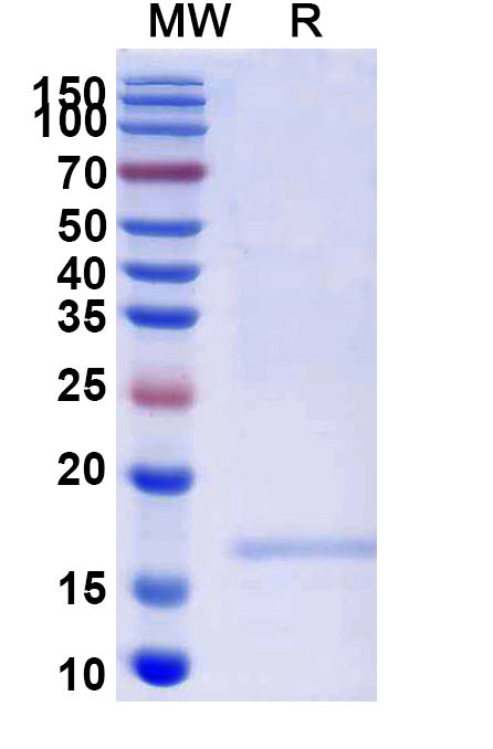SDS-PAGE for Anti-Human CD332/FGFR2(IIIb) Nanobody (SAA2047)