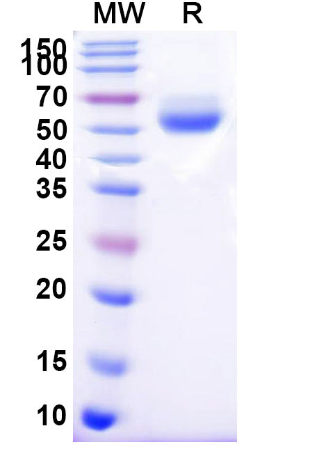 Recombinant Human CD95/FAS Protein, C-Fc