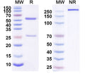 Anti-Human TYRP1 Reference Antibody (Flanvotumab) – Figure 1 of 1