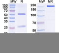 SDS-PAGE for Anti-Human GLUT4/SLC2A4 Antibody (SAA1533)