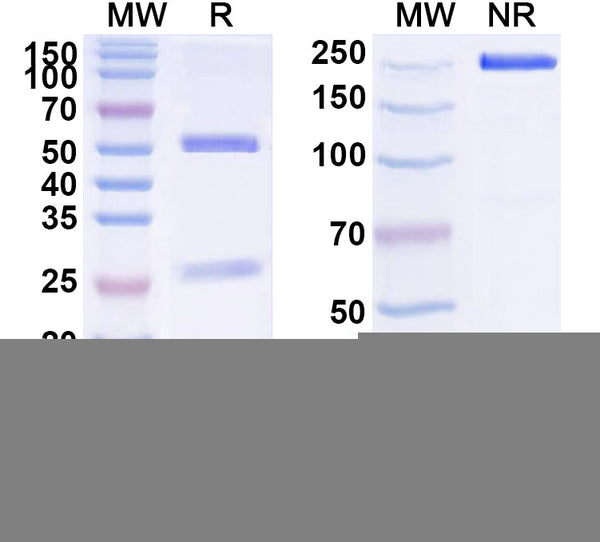 SDS-PAGE for Anti-Human GLUT4/SLC2A4 Antibody (SAA1533)