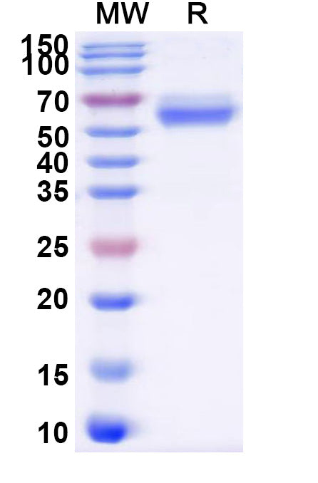 Recombinant Human CD120a/TNFRSF1A Protein, C-Fc