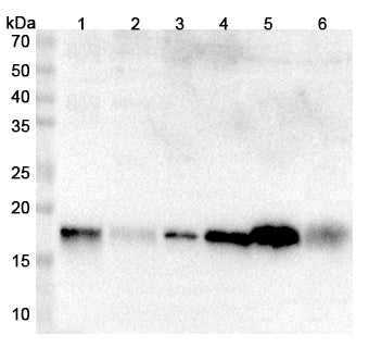 Western blot analysis was performed using anti-MYL9 polyclonal antibody at 1μg/ml on various samples.
Lane 1: C2C12 cell lysate
Lane 2: Caco2 cell lysate
Lane 3: Daudi cell lysate
Lane 4: PC12 cell lysate
Lane 5: mouse Lung
Lane 6: Mouse colon lysate
