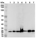 Western blot analysis was performed using anti-RPA2 polyclonal antibody at 1ug/mL on various samples.
Lane 1: SH-SY5Y cell lysate
Lane 2: Hela cell lysate
Lane 3: Jurkat cell lysate
Lane 4: MOLT-4 cell lysate
Lane 5: THP-1 cell lysate
Lane 6: Lncap cell lystae
Lane 7: 293T cell lysate