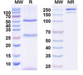 SDS-PAGE for InVivoMAb Anti-Human CD122/IL2RB Antibody (Iv0106).