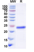 Recombinant Human DNMT1 Protein, N-His