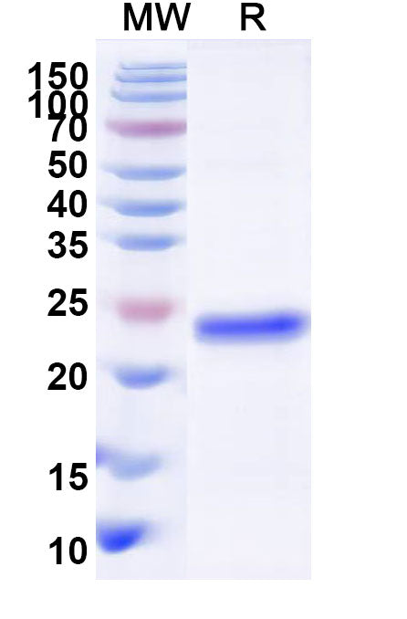 Recombinant Human DNMT1 Protein, N-His