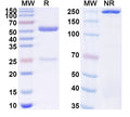 SDS-PAGE for Anti-Human DNMT1 IP Antibody (SAA0251)