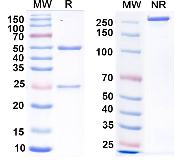 SDS-PAGE for Anti-Calretinin Antibody (L122/68)