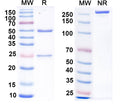 SDS-PAGE for Anti-Calretinin Antibody (L122/77)