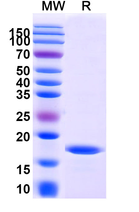 SDS-PAGE for Anti-Human CD252/TNFSF4/OX40L Nanobody (SAA1277)