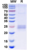 Recombinant Human CD252/TNFSF4/OX40L Protein, C-His