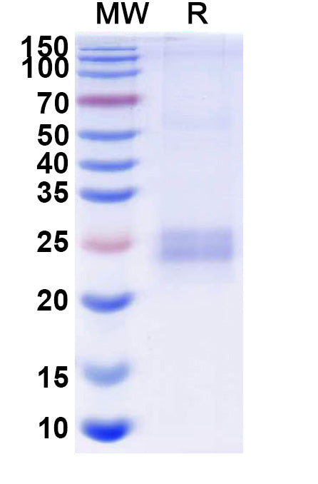 Recombinant Human CD252/TNFSF4/OX40L Protein, C-His