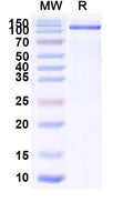 Recombinant Human CD21/CR2 Protein, C-His