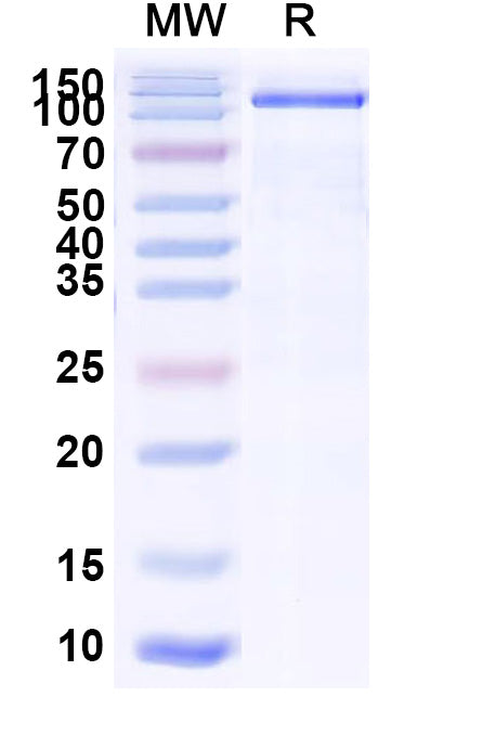 Recombinant Human CD21/CR2 Protein, C-His