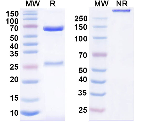 SDS-PAGE for Anti-Human CD21/CR2 Antibody (SAA1459)