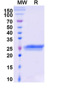 Anti-Human VEGF Reference Antibody (Ranibizumab) – Figure 1 of 1