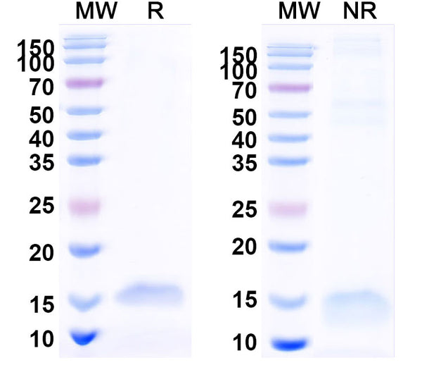 SDS-PAGE for Anti-Human VEGFA Nanobody (SAA0902)